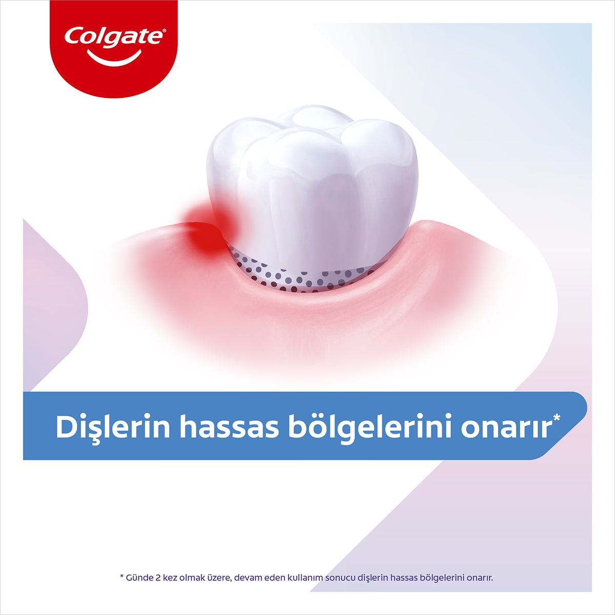 Diş Macunu Total Profesyonel Beyazlık 75 ml