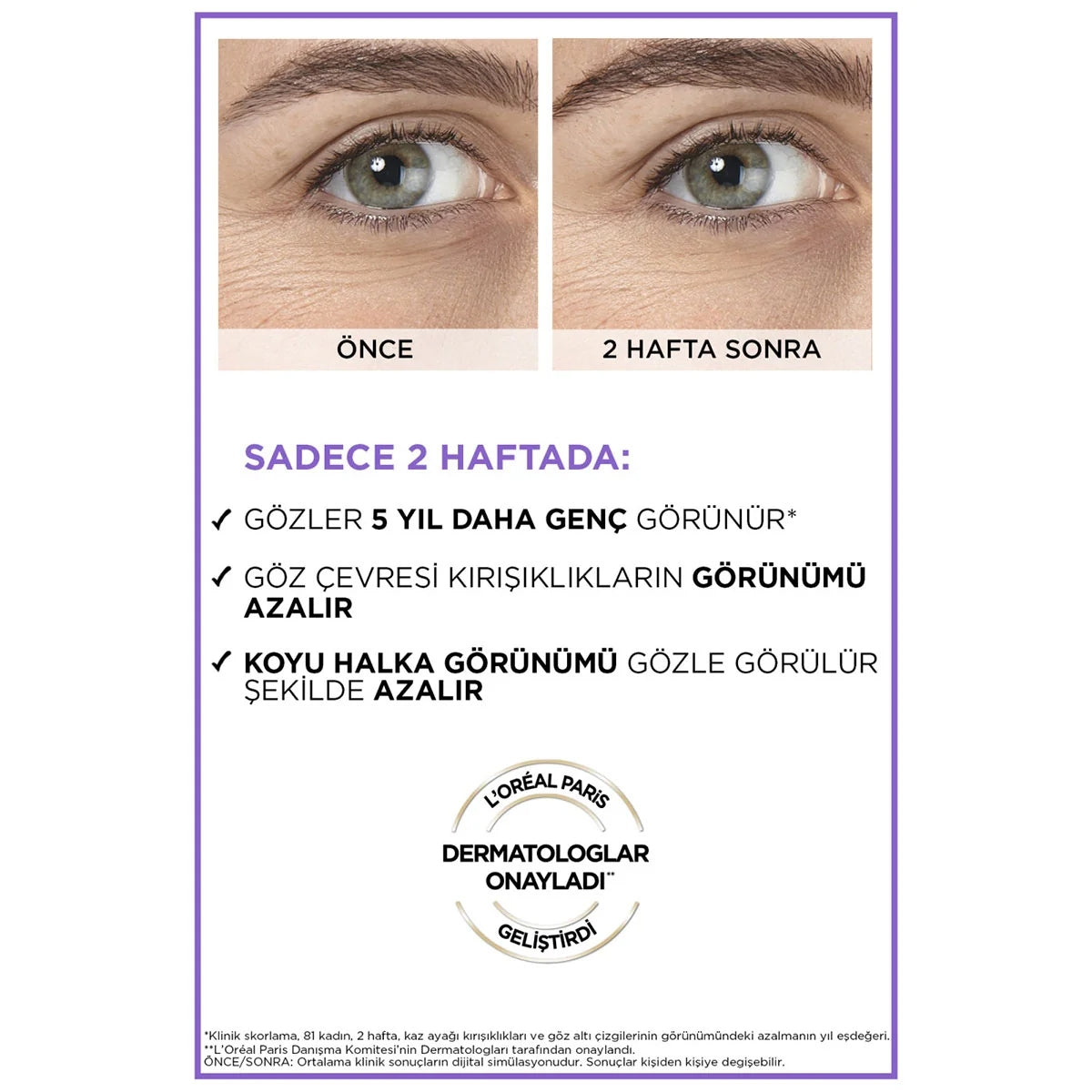 Göz Bakım Serumu Revitalift Filler 20 ml