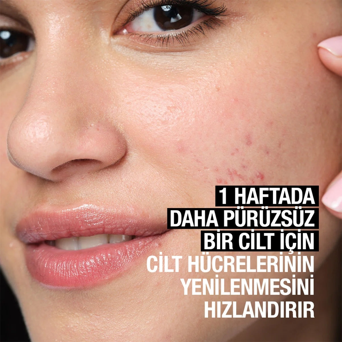 TONİK SİVİLCE KARŞITI PEELİNG ETKİLİ 125 ML