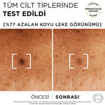 Bright Reveal Sivilce, Güneş, Yaşlanma Lekelerinde Etkili Koyu Leke
Karşıtı Serum 30 ml

