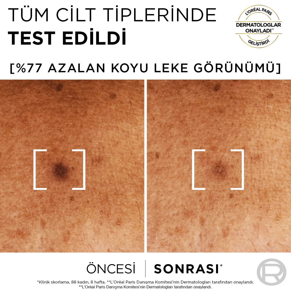 Bright Reveal Sivilce, Güneş, Yaşlanma Lekelerinde Etkili Koyu Leke
Karşıtı Serum 30 ml

