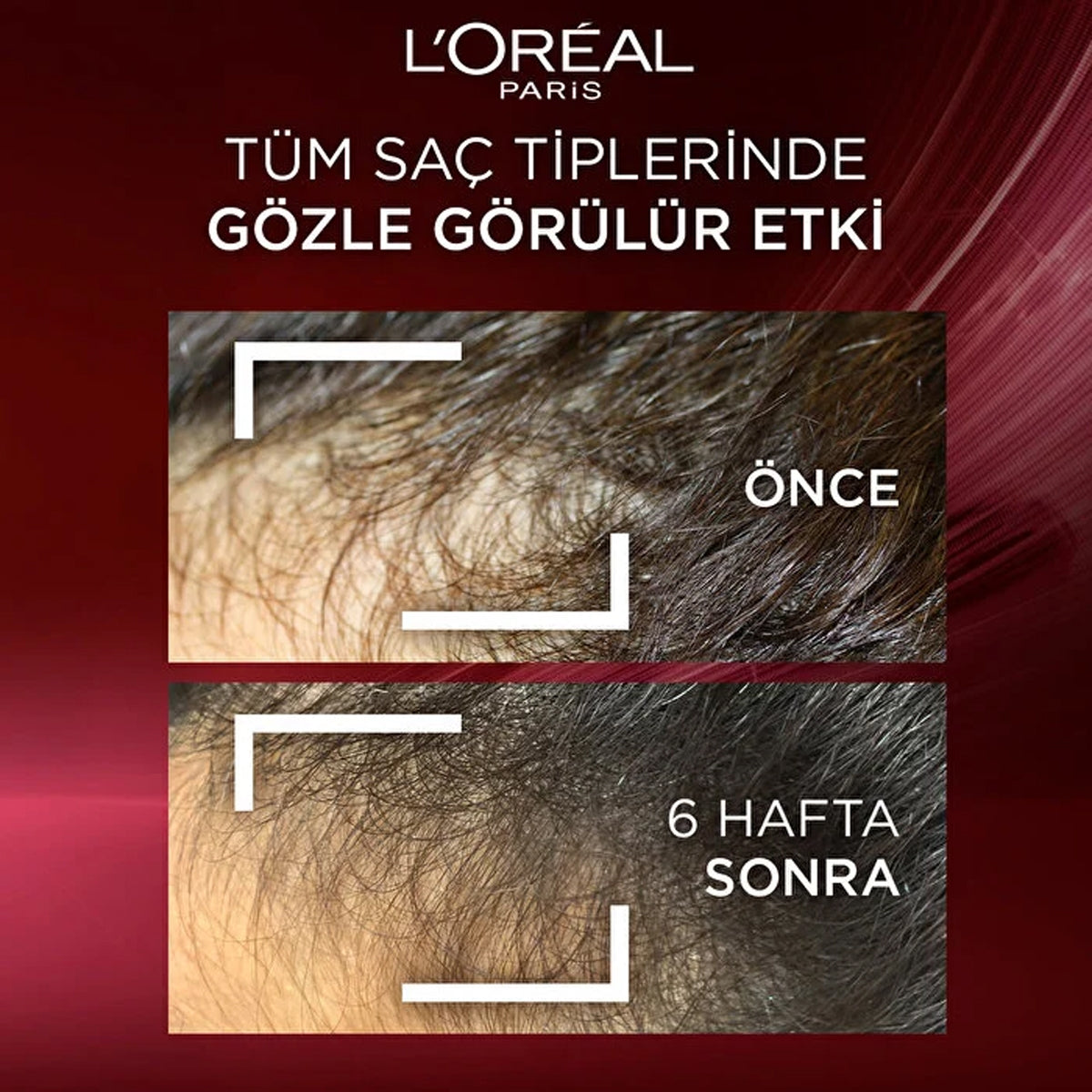 Komple Direnç Dökülme Karşıtı Saç Bakım Kremi 250 ml