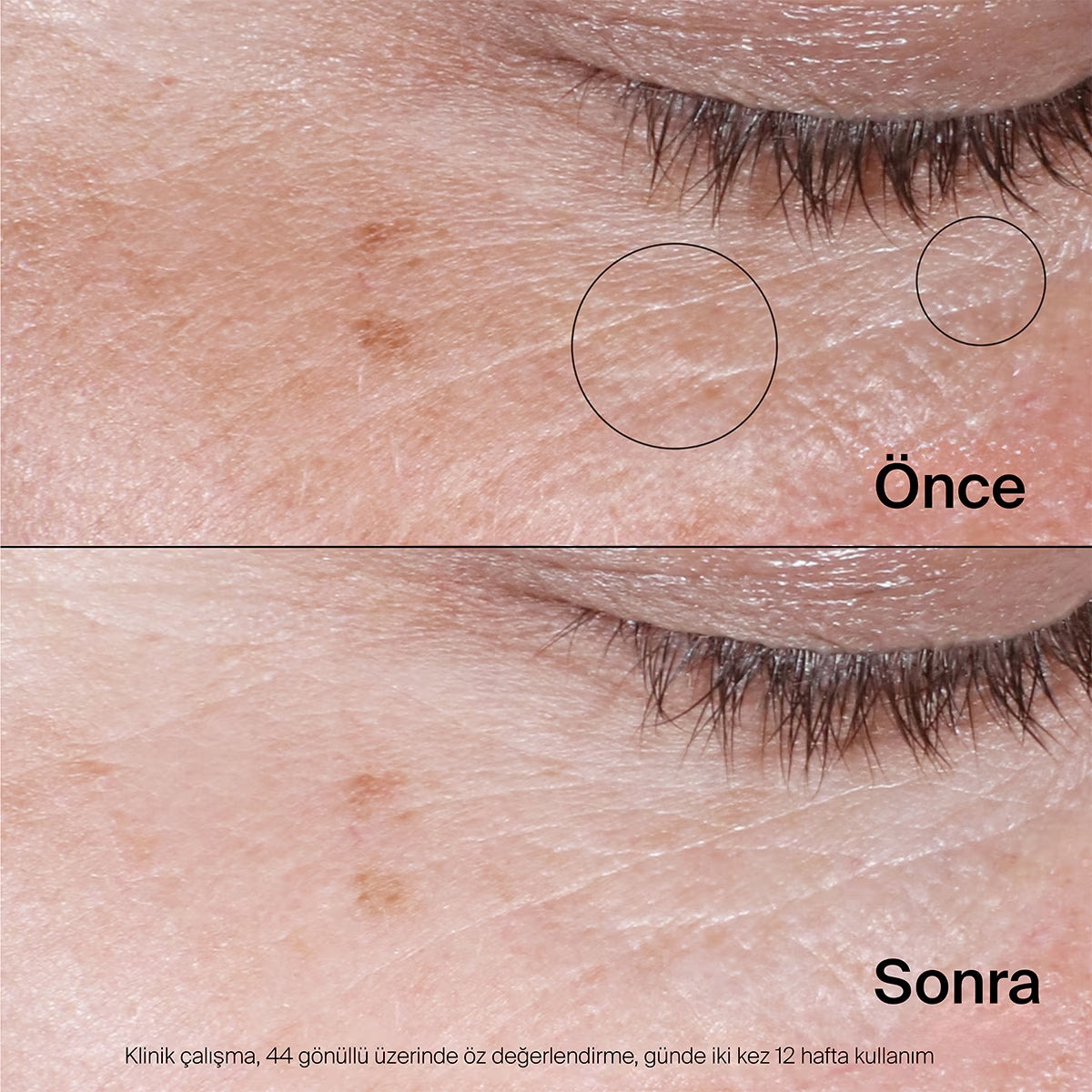 Neutrogena Collagen Bank Canlandırıcı Jel Göz Kremi 15 ml