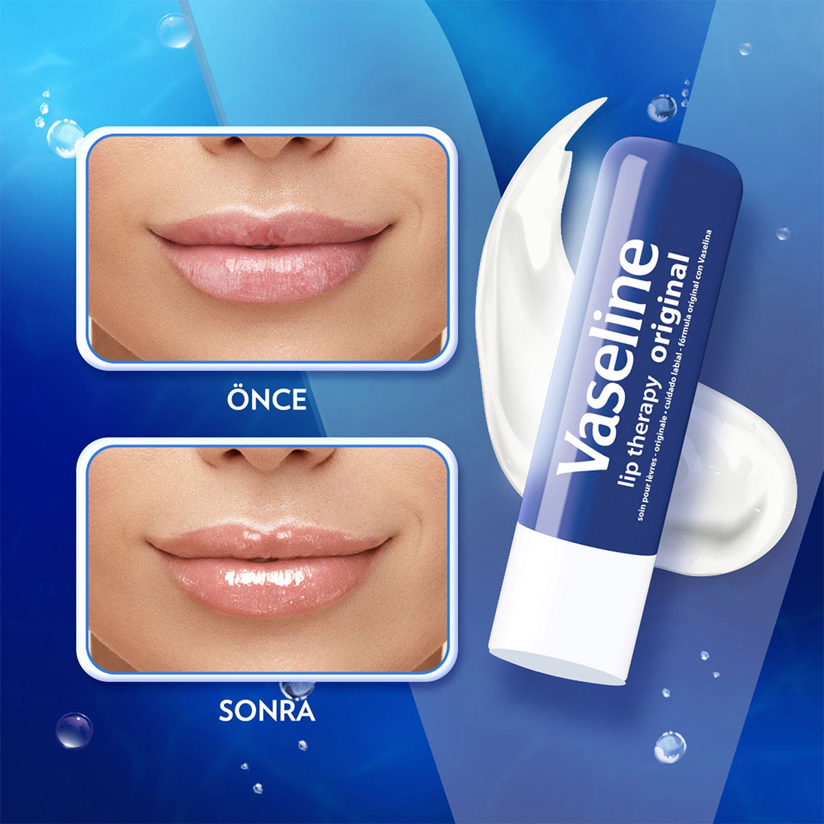 Vaseline Lip Threapy Orginal Dudak Koruyucu 4,8 gr