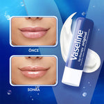 Vaseline Lip Threapy Orginal Dudak Koruyucu 4,8 gr
