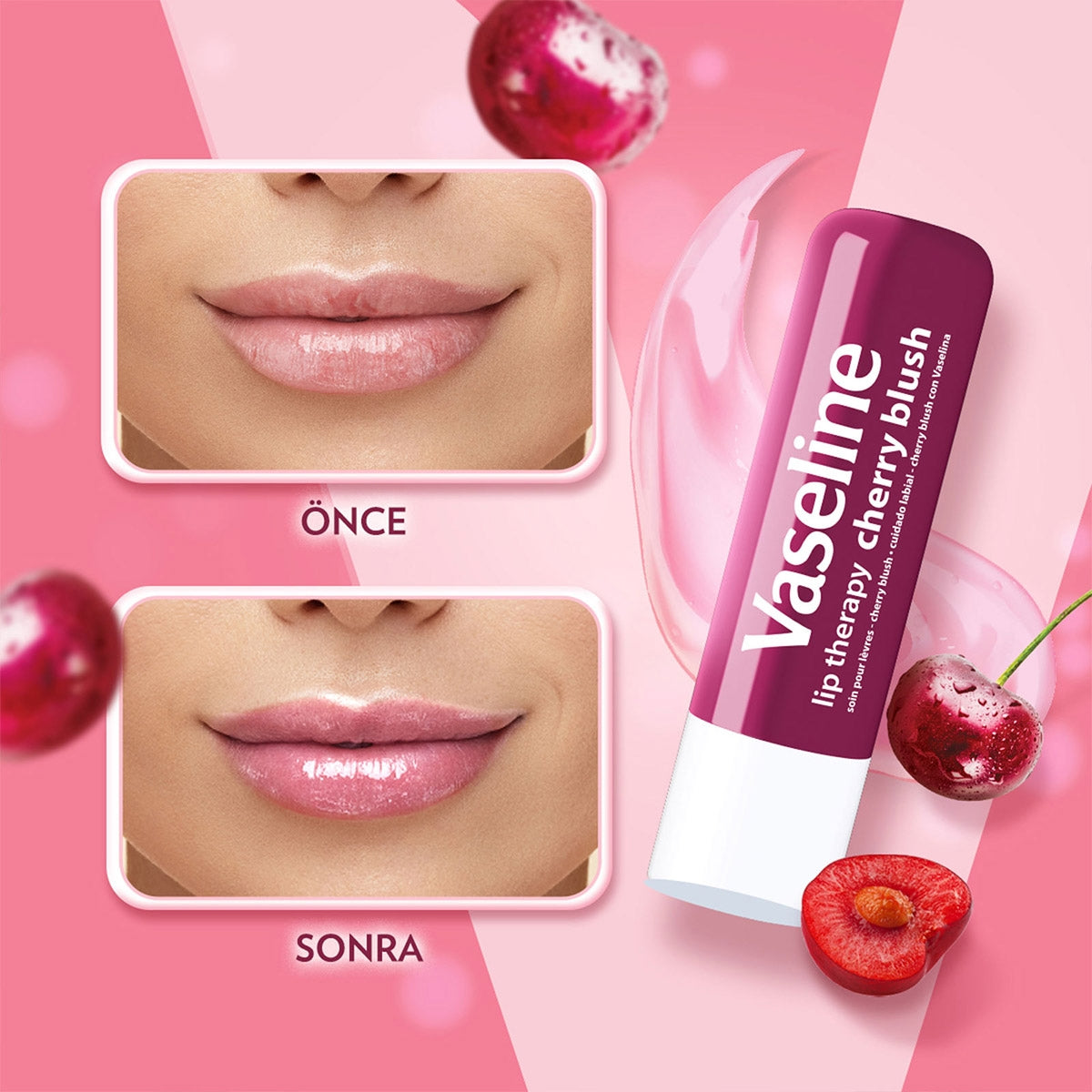 Vaseline Lip Threapy Cherry Dudak Koruyucu 4,8 gr