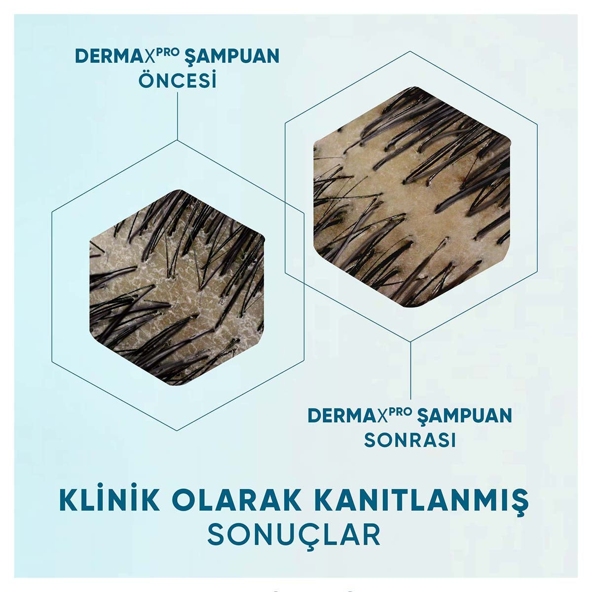 Şampuan Dermaxpro Yatıştırıcı 300 ml