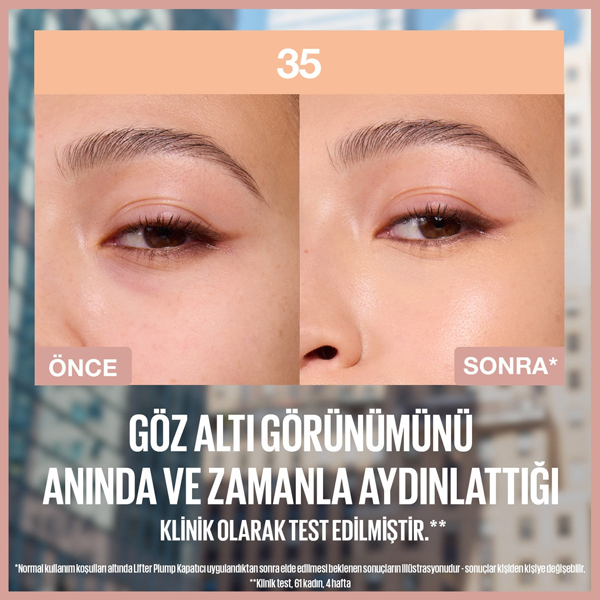Lifter Kapatıcı 35
