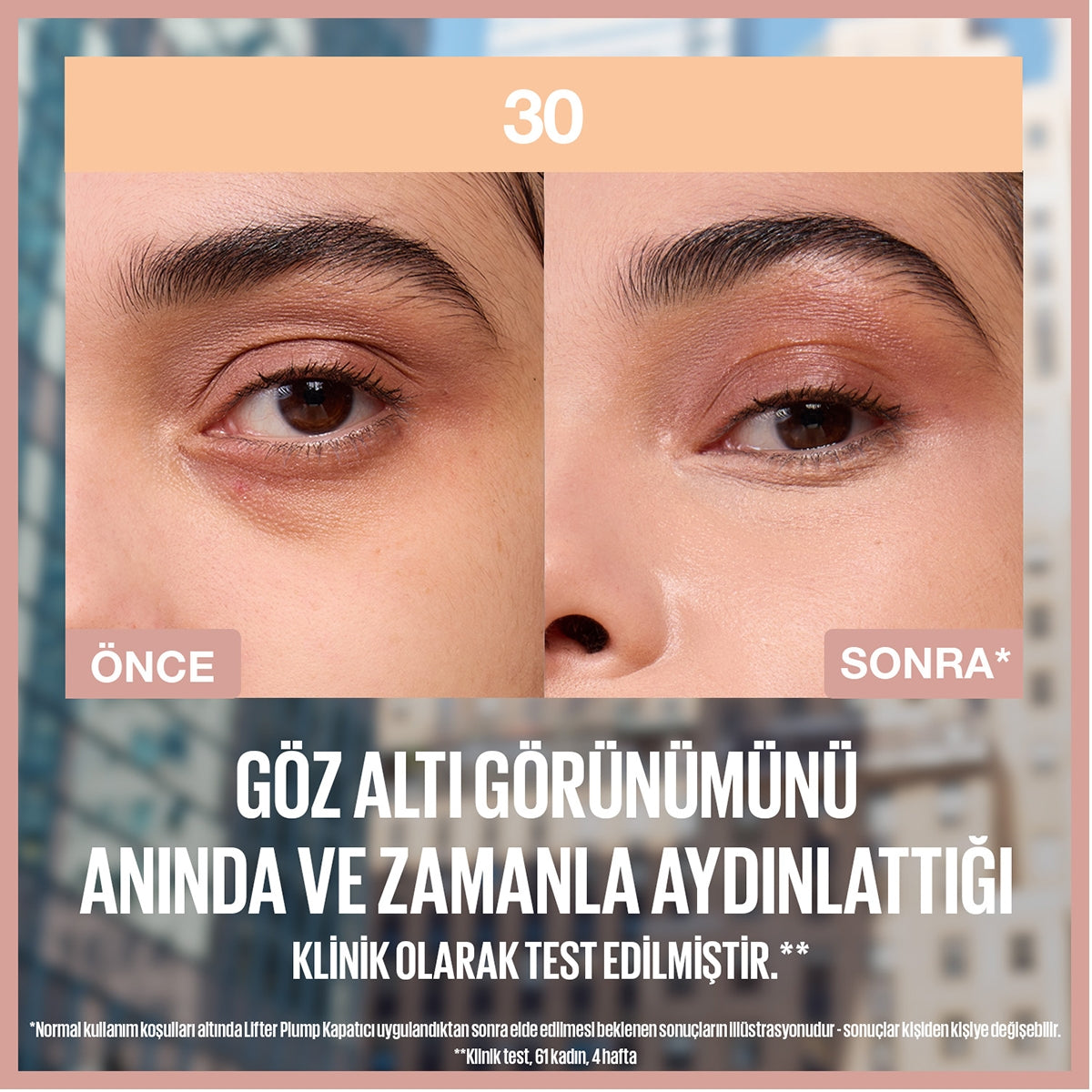 Lifter Kapatıcı 30
