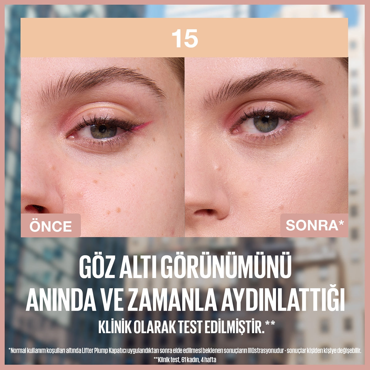 Lifter Kapatıcı 15
