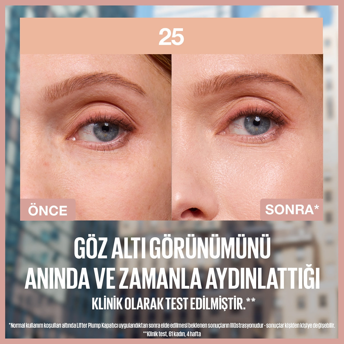 Lifter Kapatıcı 25
