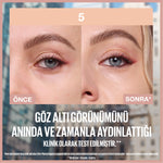 Lifter Kapatıcı 05
