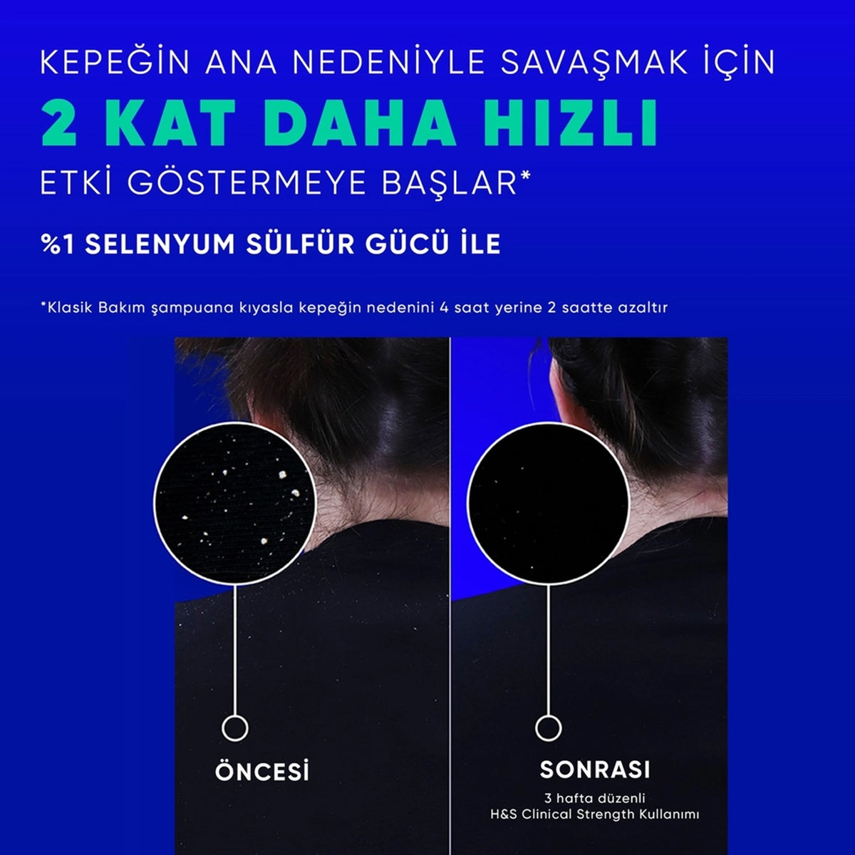 ŞAMPUAN CLINICAL KAŞINTI KARŞITI 400ML