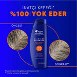 ŞAMPUAN CLINICAL KURU SAÇ DERİSİ 400ML