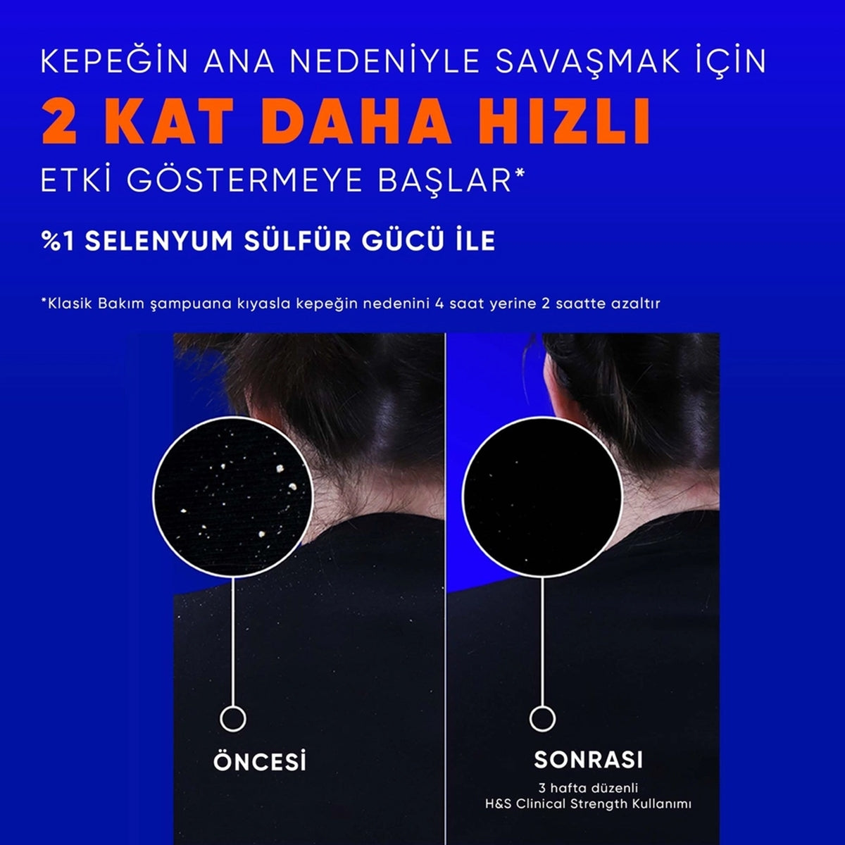 ŞAMPUAN CLINICAL KURU SAÇ DERİSİ 400ML