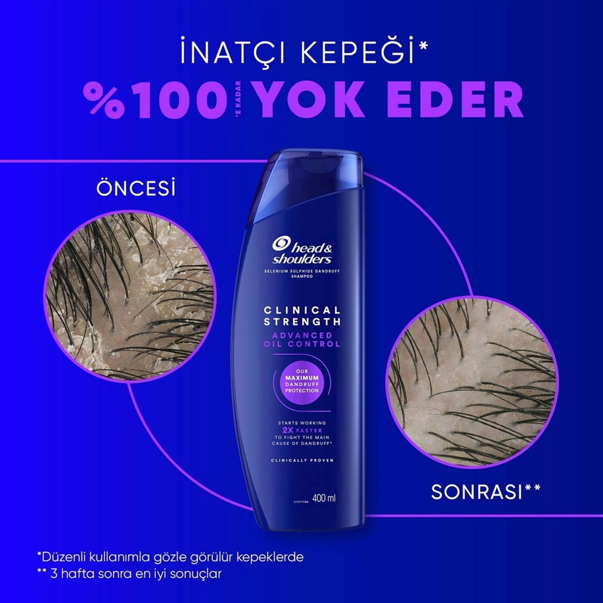 ŞAMPUAN CLINICAL YAĞLI SAÇ DERİSİ 400ML