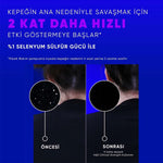 ŞAMPUAN CLINICAL YAĞLI SAÇ DERİSİ 400ML