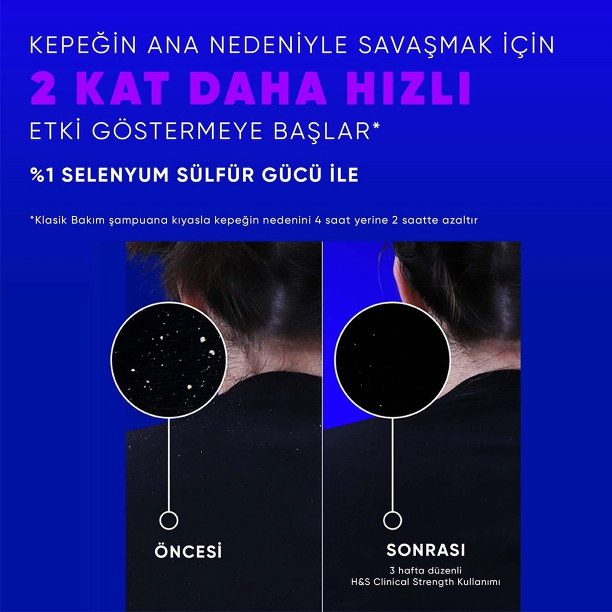 ŞAMPUAN CLINICAL YAĞLI SAÇ DERİSİ 400ML